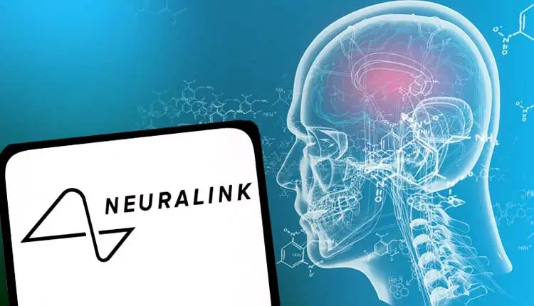 Elon Musk's Neuralink to Start the human trial of Brain implant for paralysis Patients