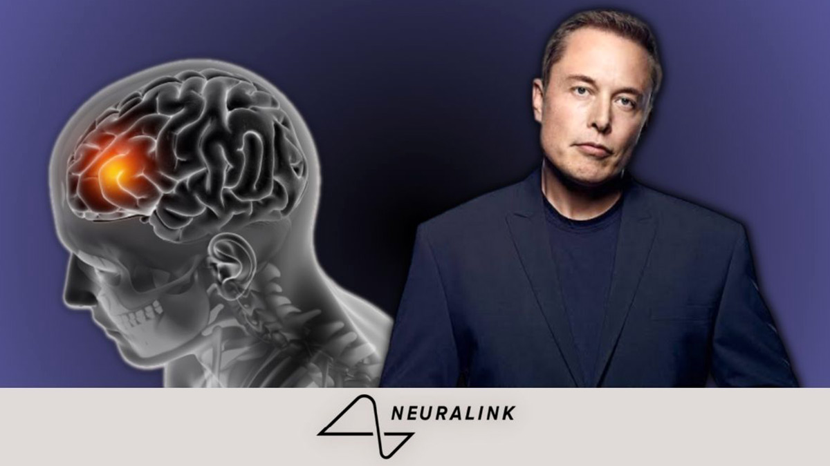 What are the Pros and Cons of Elon Musk's Brain Chip Neuralink?